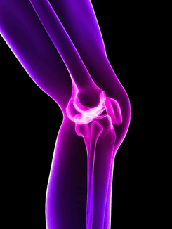 Conditions, back, Arthritis, treatment